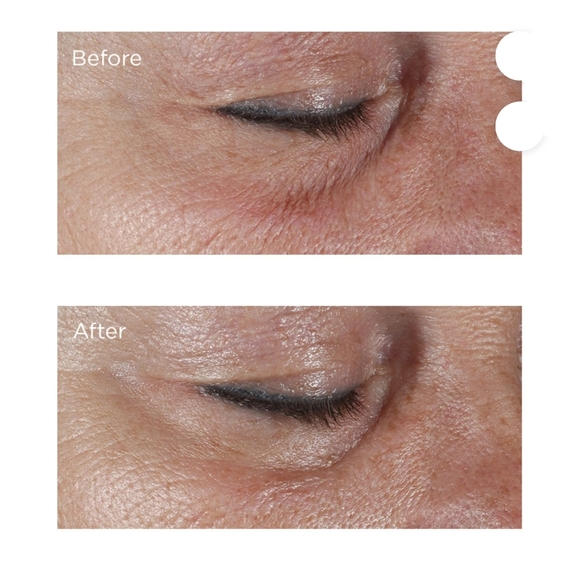 [Perricone MD] NWT Firming Eye Cream Full 0.5 oz - Picture 2 of 8